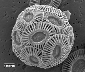 A photo of a coccolithophore, a single-celled algae.