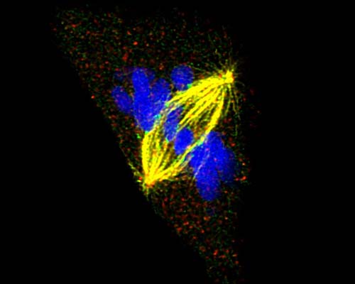 Microscope image of chromosomes moving during cell division