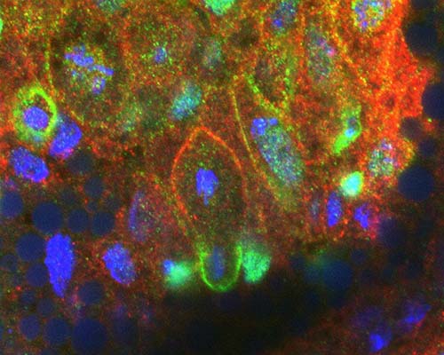 Microscope image of neuroblasts undergoing cell division