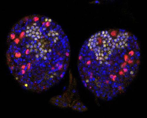 Microscope image of cells in a Drosophila (fruit fly) larval brain